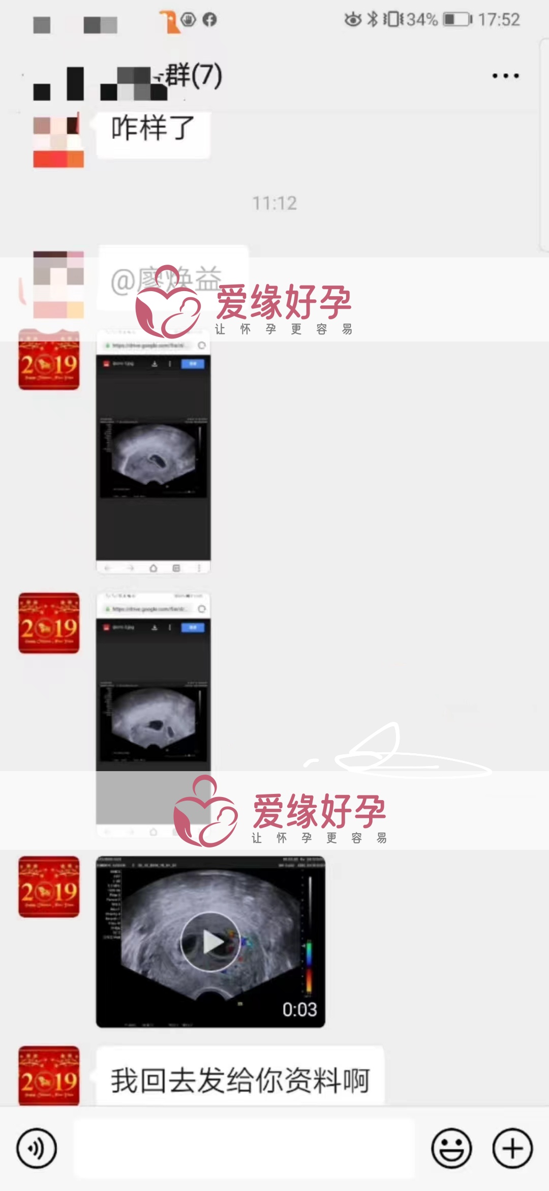 爱缘好孕乌克兰双胎宝宝B超顺利通过
