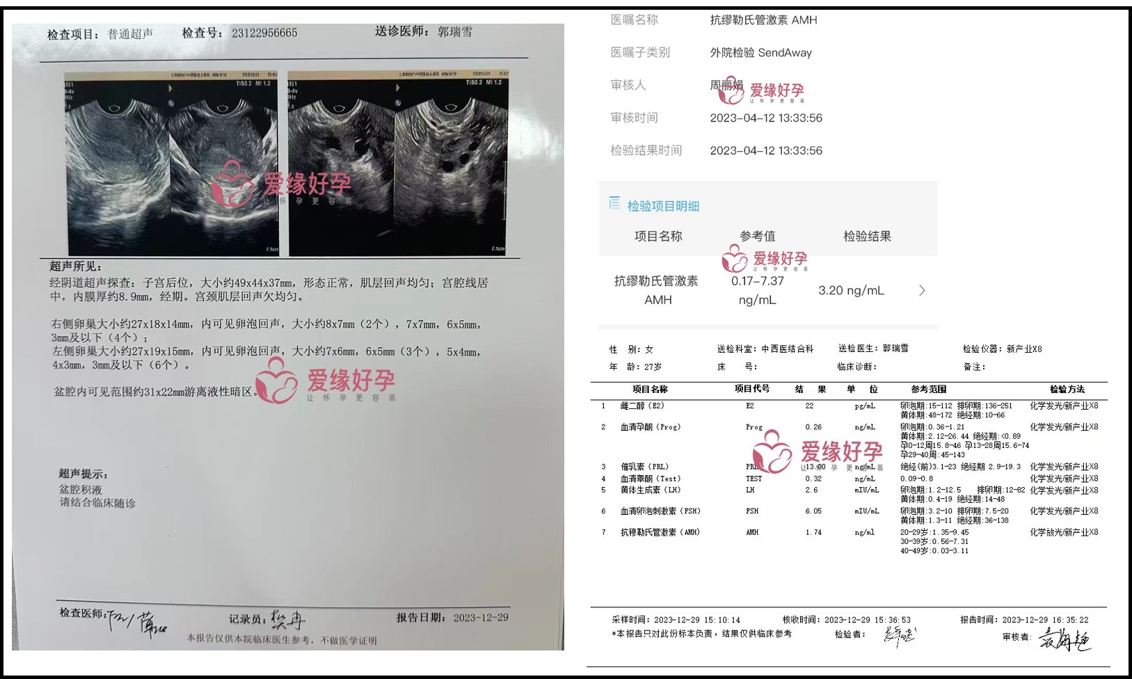 北京夫妇哈萨克斯坦试管婴儿助孕11个月成功得子 | 成功故事