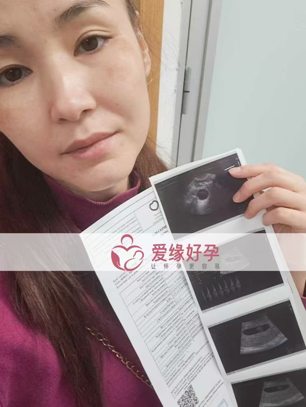 格鲁吉亚试管婴儿助孕爱心使者6周产检顺利通过