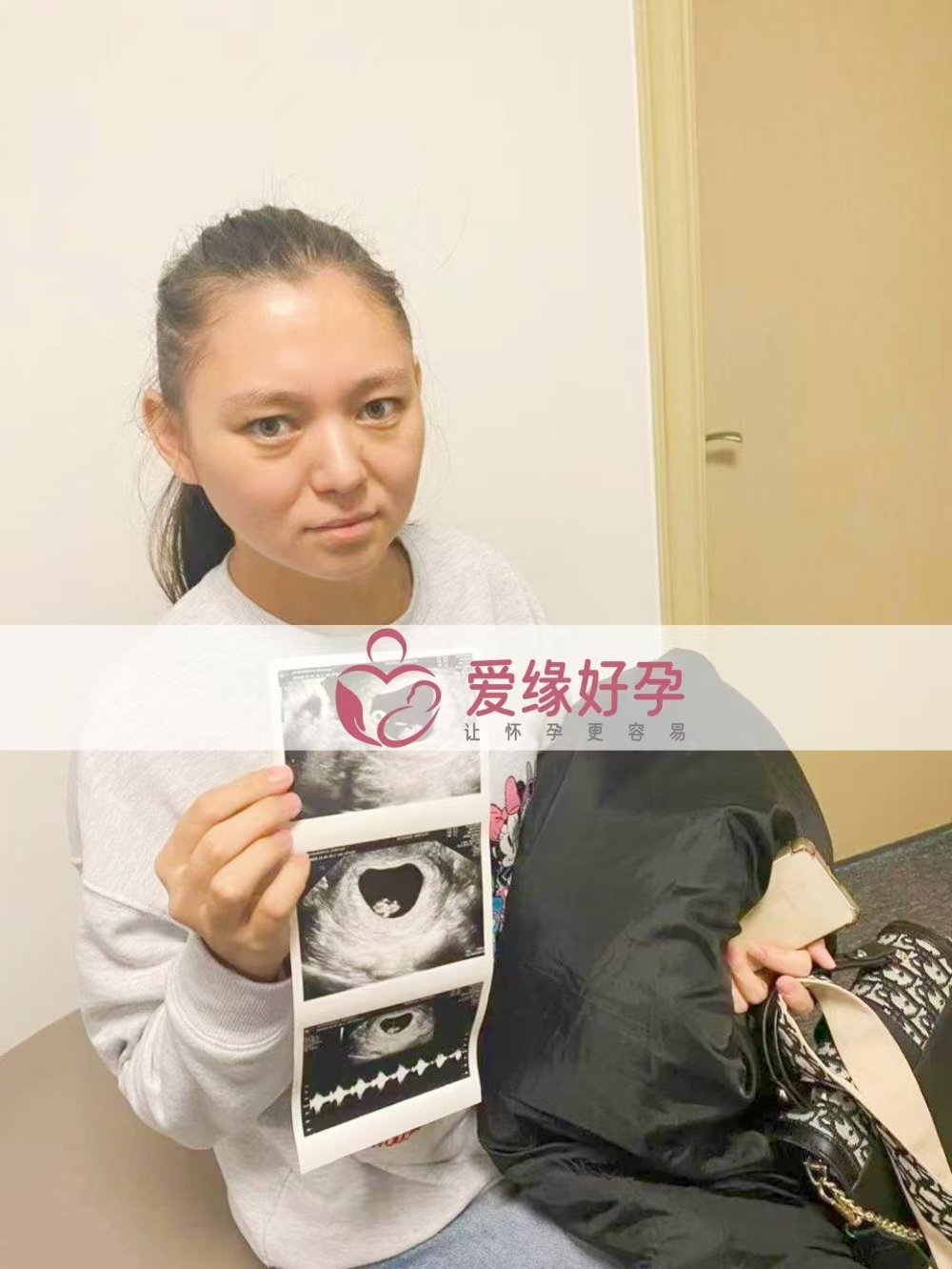 格鲁吉亚试管婴儿助孕爱心使者，新生命迈出第一步