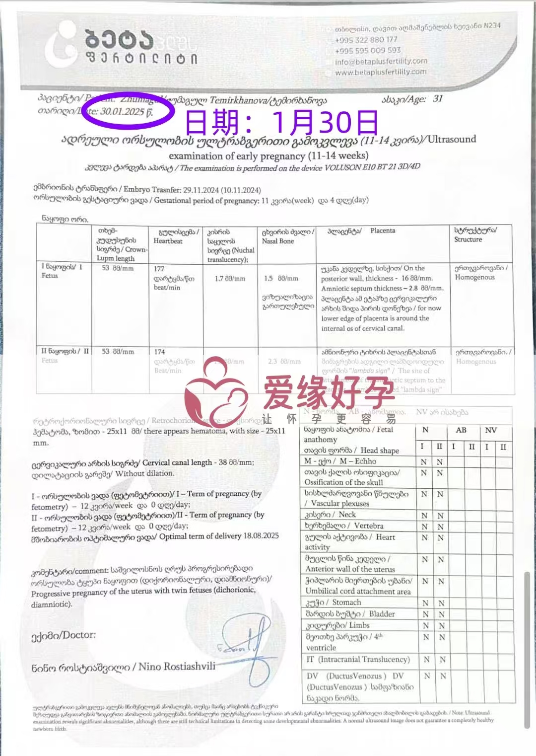 格鲁吉亚试管婴儿助孕爱心使者开启幸福新旅程