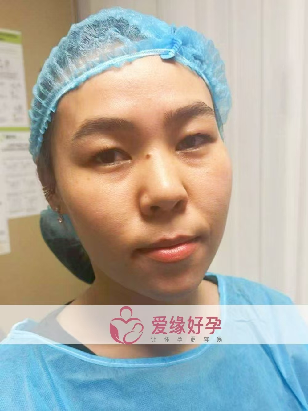 格鲁吉亚试管婴儿助孕爱心使者顺利完成移植