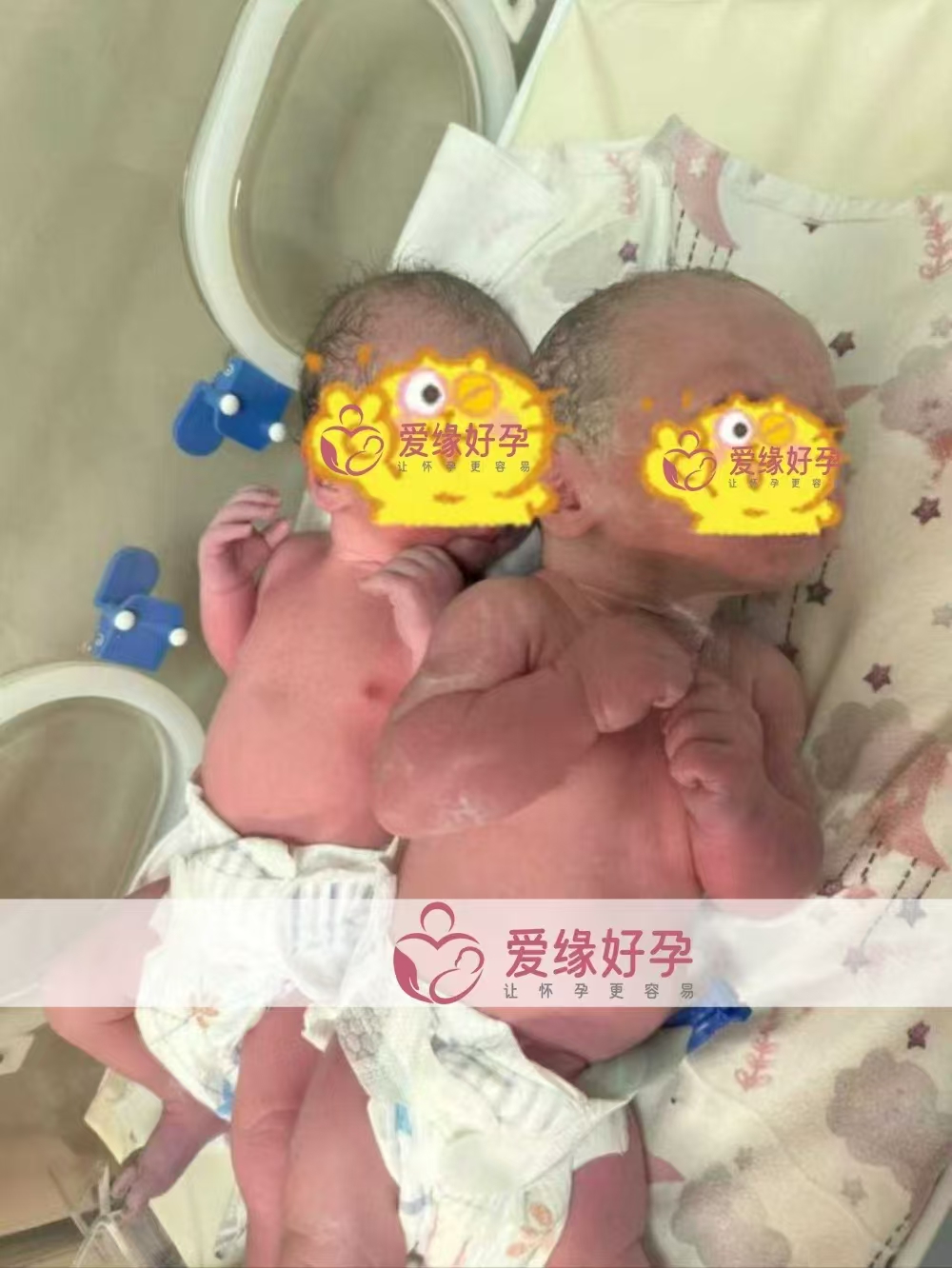 格鲁吉亚试管婴儿助孕爱心使者双胞胎儿子顺产诞生