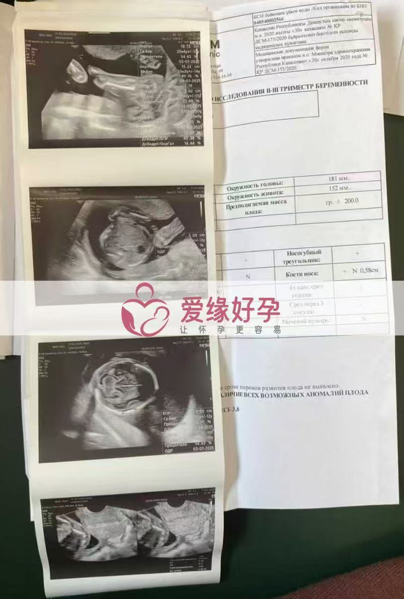 哈萨克斯坦试管婴儿助孕爱心使者20周产检顺利通过