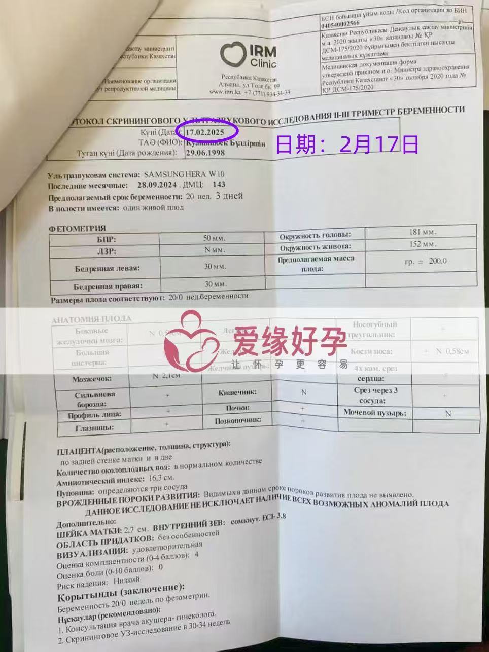 哈萨克斯坦试管婴儿助孕爱心使者20周产检顺利通过
