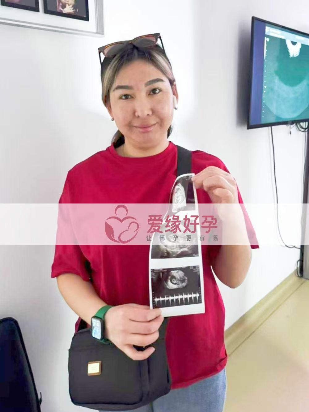 格鲁吉亚试管婴儿助孕爱心使者10周产检顺利通过
