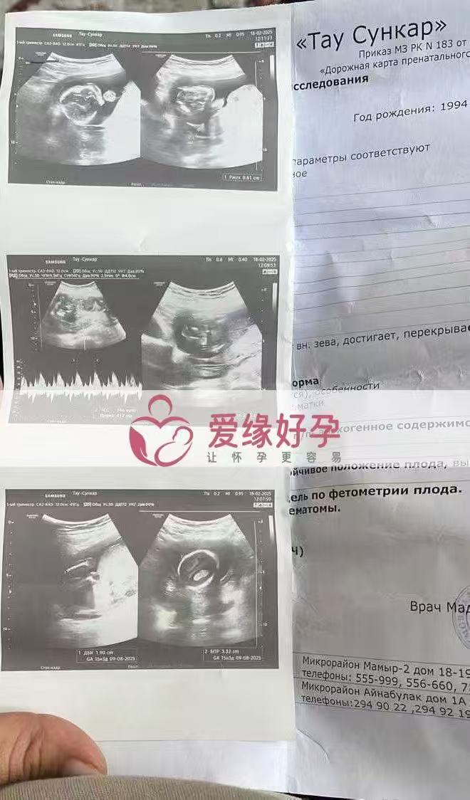 格鲁吉亚试管婴儿助孕爱心使者15周产检顺利通过