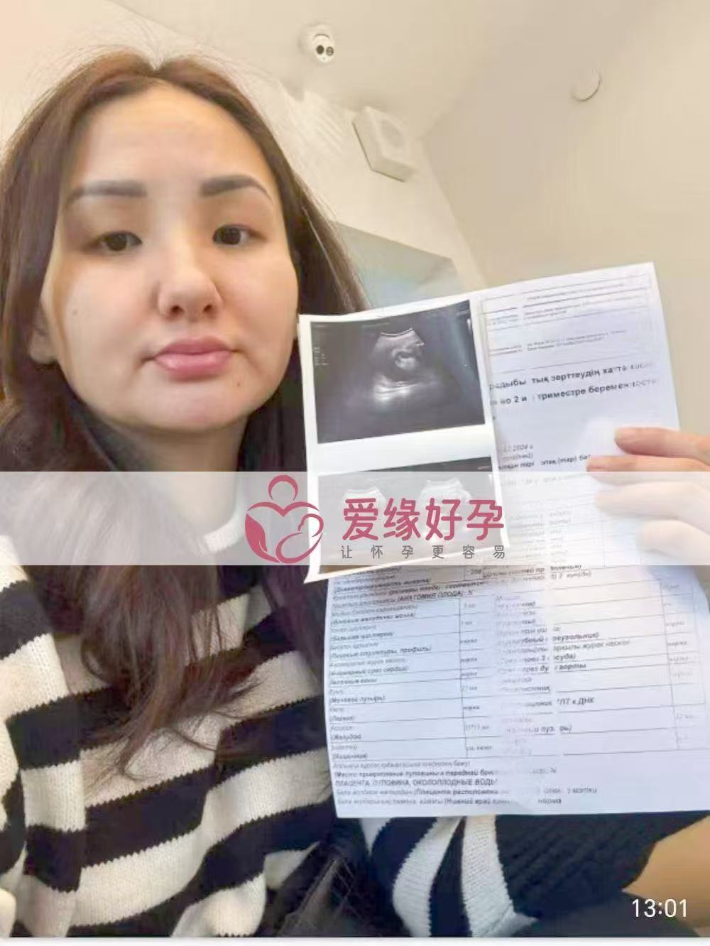 格鲁吉亚试管婴儿助孕爱心使者29周产检过关，孕期进展顺利