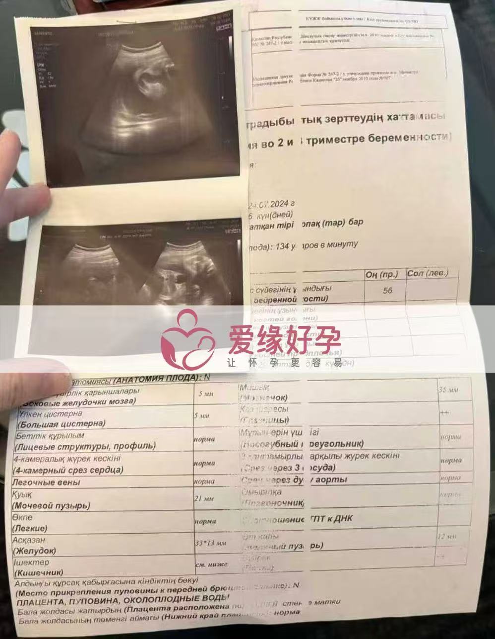 格鲁吉亚试管婴儿助孕爱心使者29周产检过关，孕期进展顺利