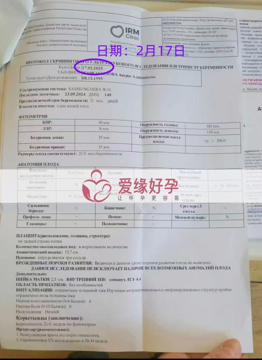 哈萨克斯坦试管婴儿助孕爱心使者21周产检顺利通过