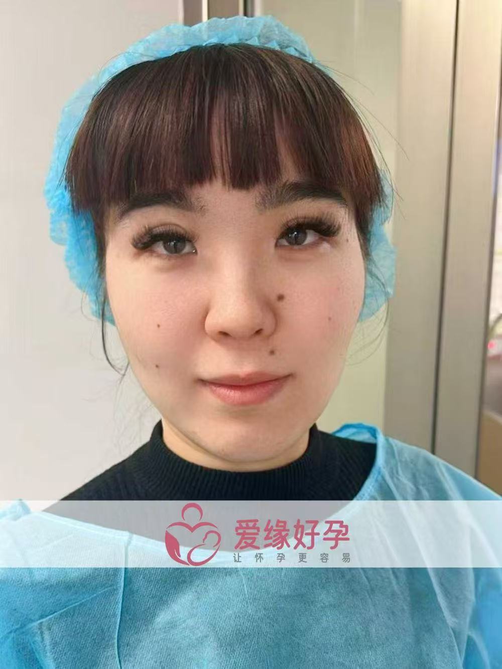 格鲁吉亚试管婴儿助孕爱心使者顺利完成移植