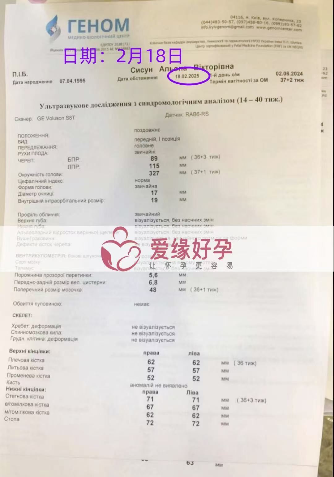 乌克兰试管婴儿助孕爱心使者36周产检顺利，孕期接近尾声