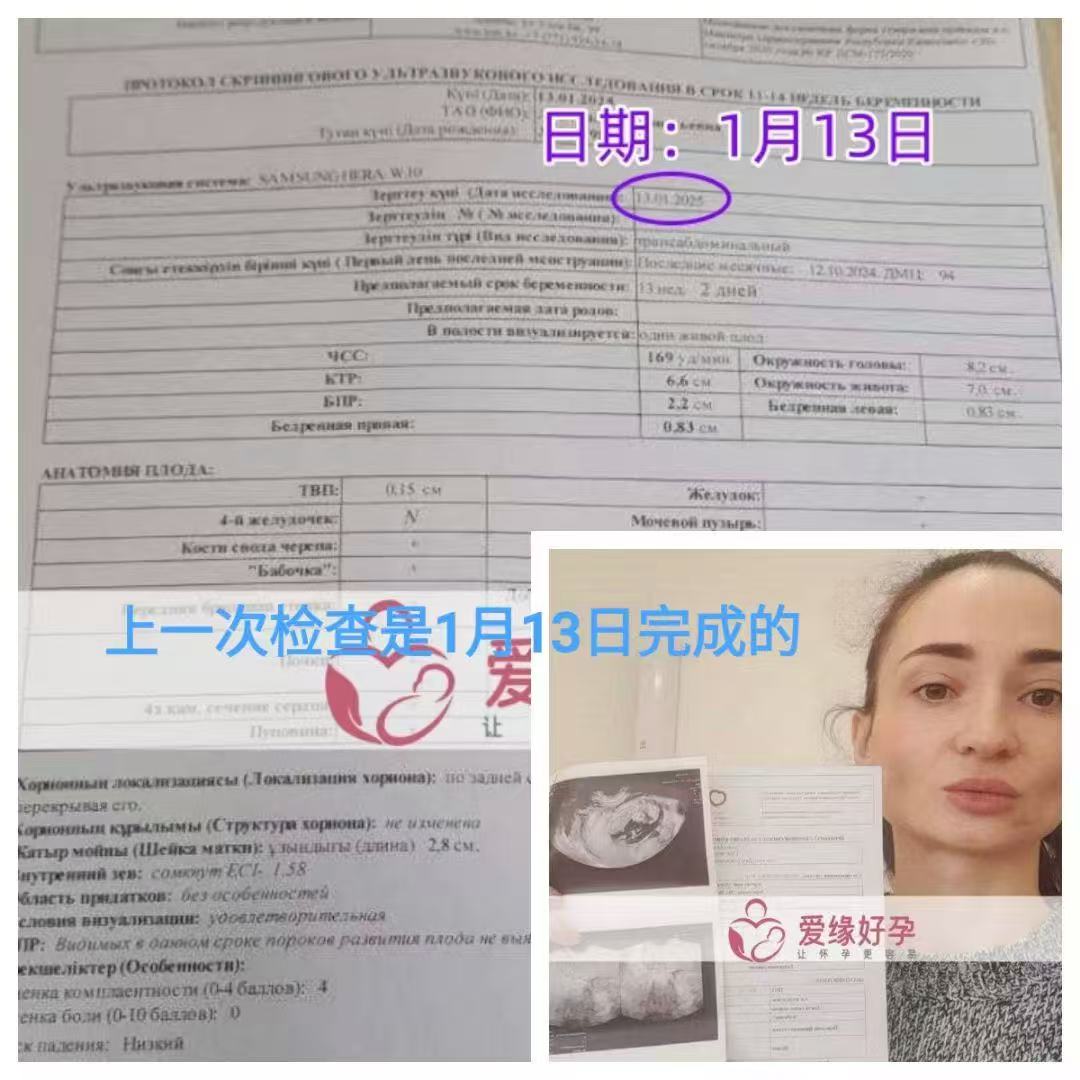 格鲁吉亚试管婴儿助孕爱心使者19周产检顺利通过