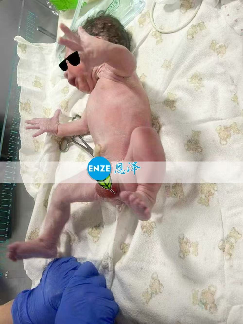 格鲁吉亚试管婴儿助孕宝贝健康诞生