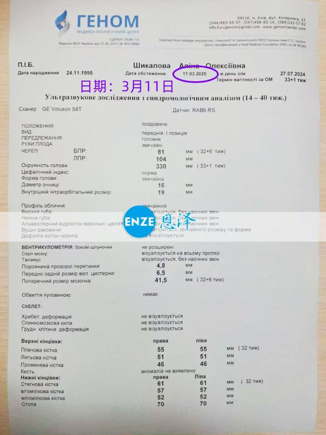 格鲁吉亚试管婴儿助孕爱心使者32周产检顺利通过