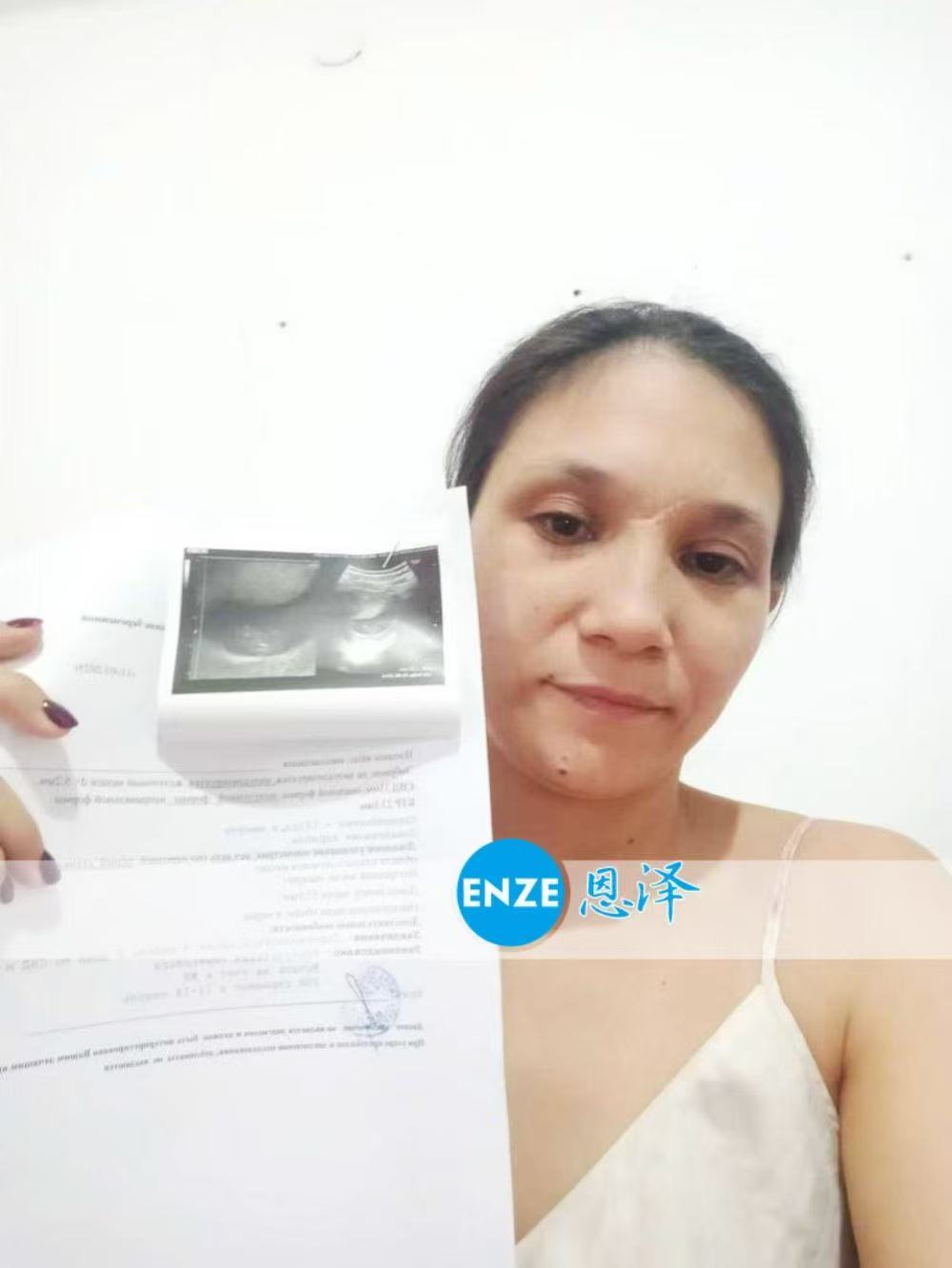 格鲁吉亚试管婴儿助孕爱心使者9周产检顺利过关