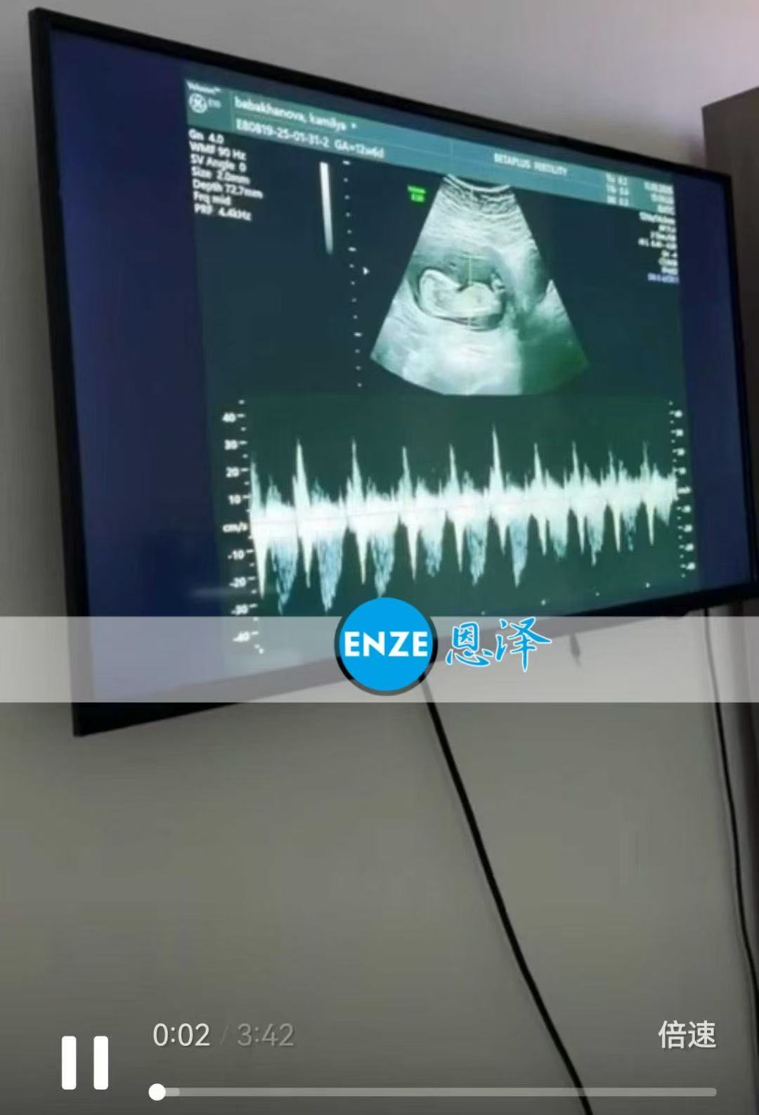 格鲁吉亚试管婴儿助孕爱心使者通过13周产检，正式度过风险期