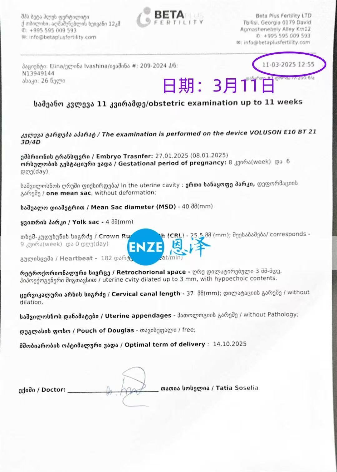 格鲁吉亚试管婴儿助孕爱心使者8周产检顺利通过