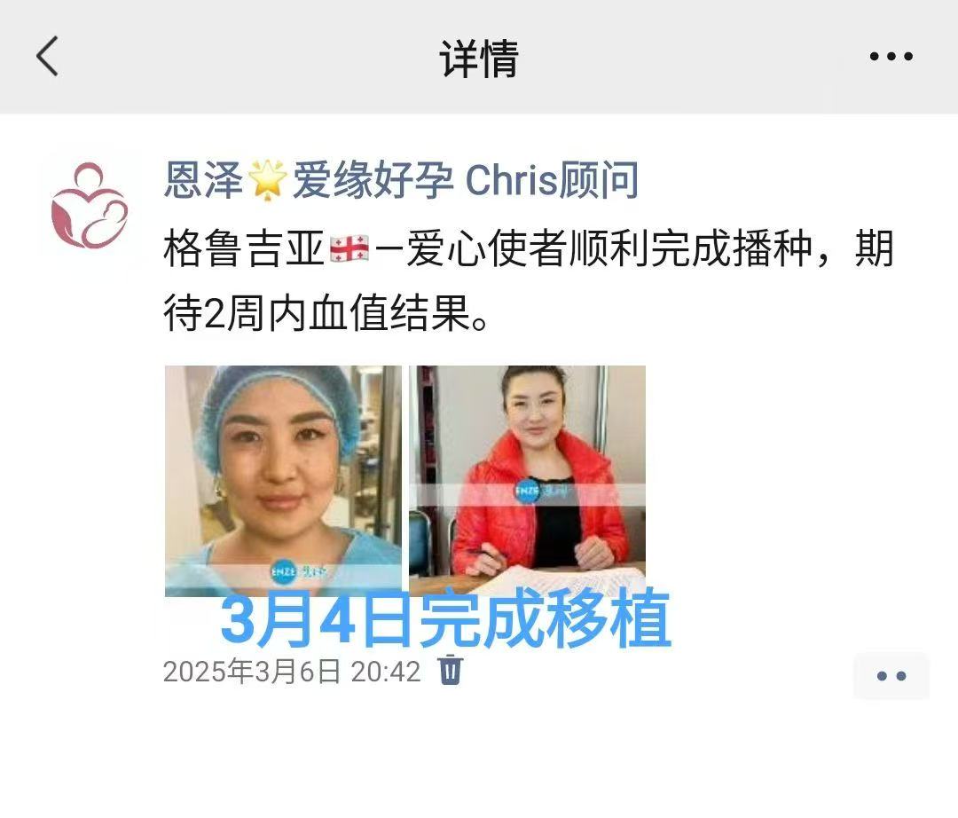 格鲁吉亚试管婴儿助孕爱心使者成功着床