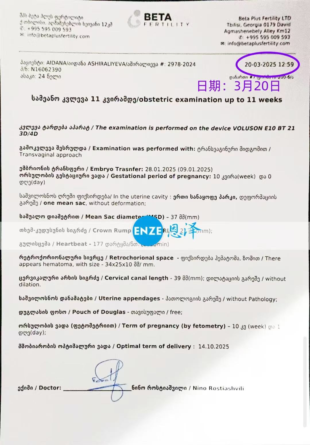 格鲁吉亚试管婴儿助孕爱心使者10周产检顺利过关