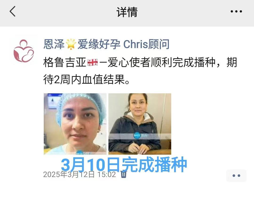 格鲁吉亚试管婴儿助孕爱心使者着床成功