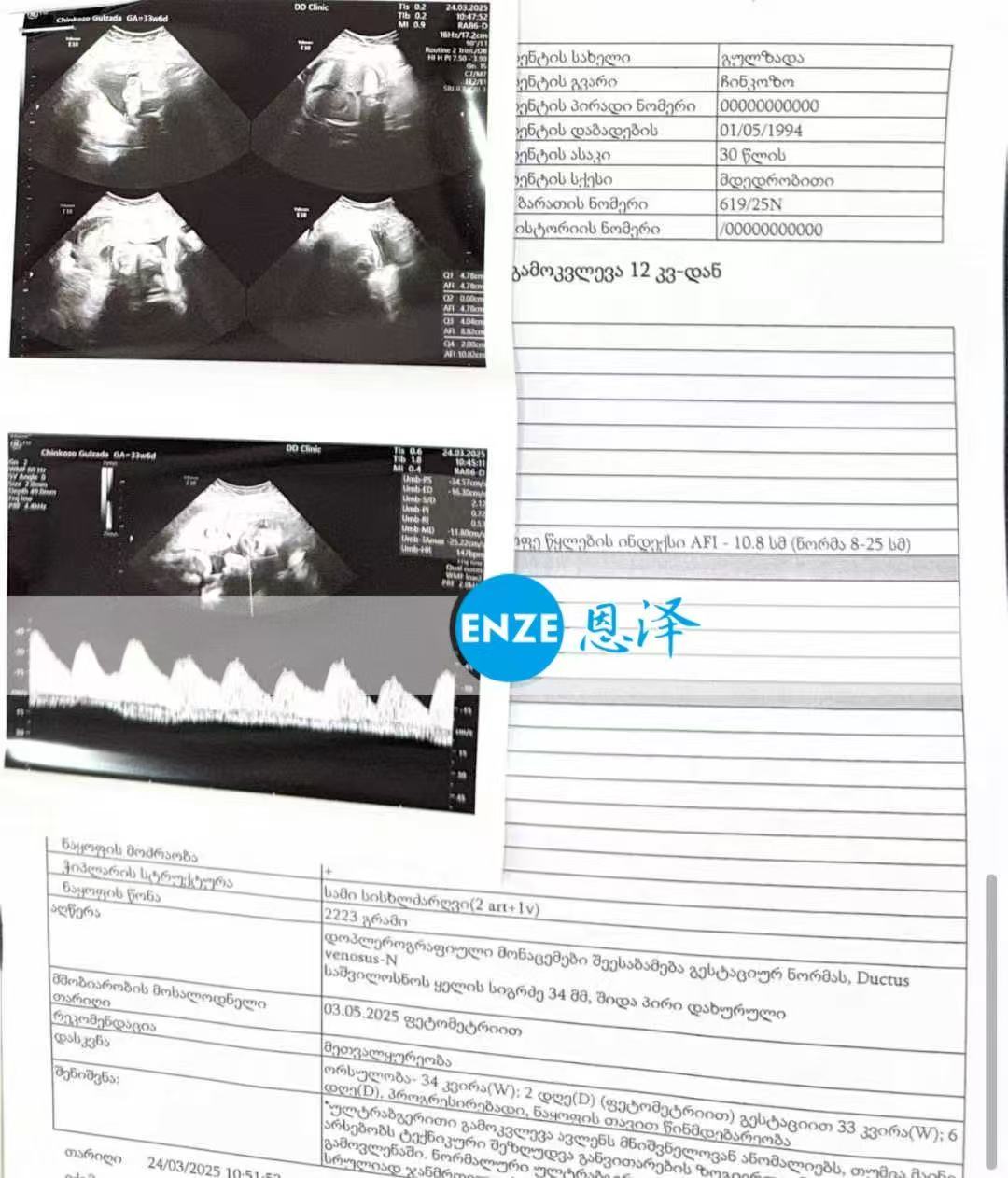 格鲁吉亚试管婴儿助孕爱心使者顺利通过34周产检