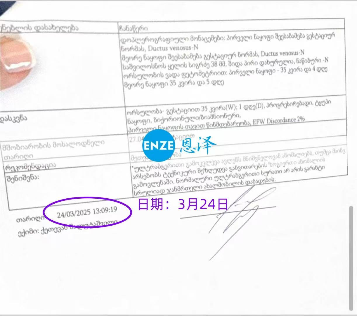 格鲁吉亚试管婴儿助孕爱心使者即将迎接龙凤胎降生