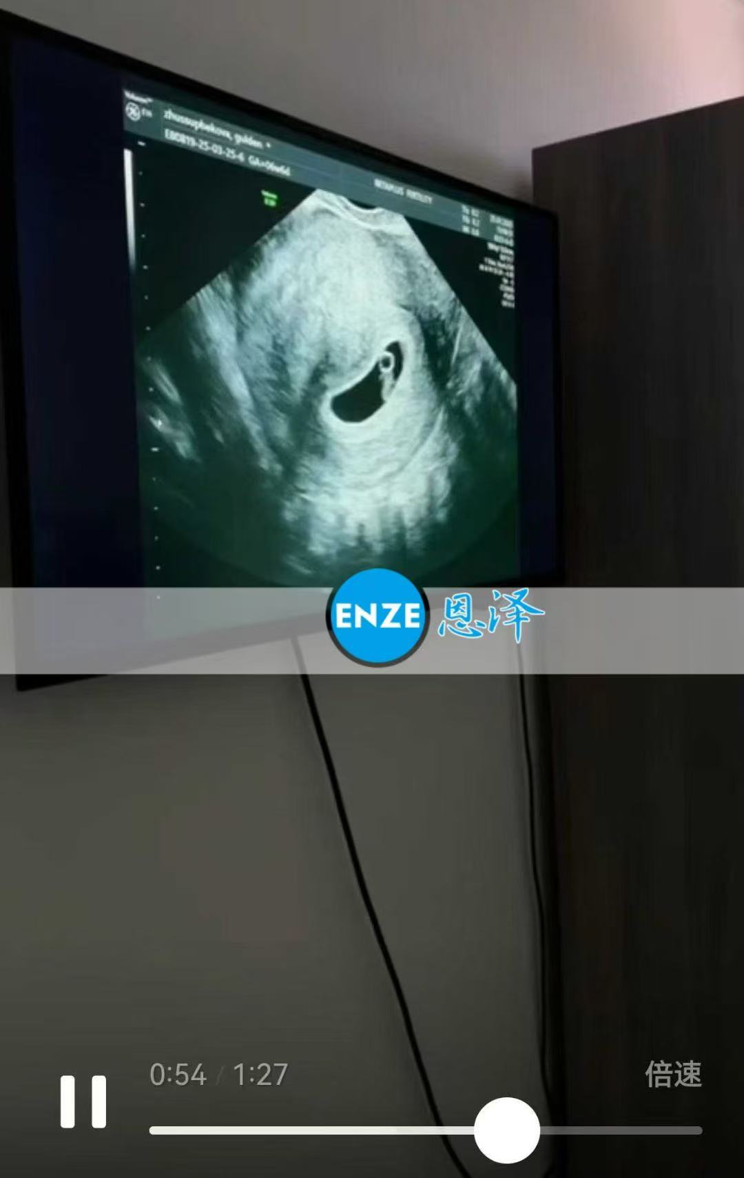 格鲁吉亚试管婴儿助孕爱心使者成功通过6周产检