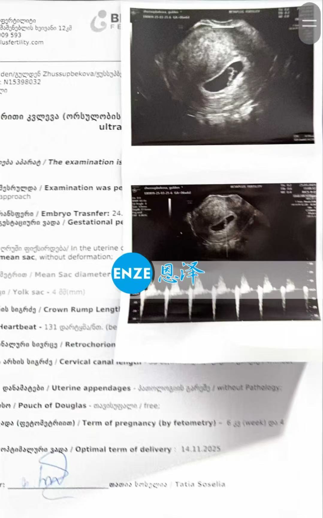 格鲁吉亚试管婴儿助孕爱心使者成功通过6周产检