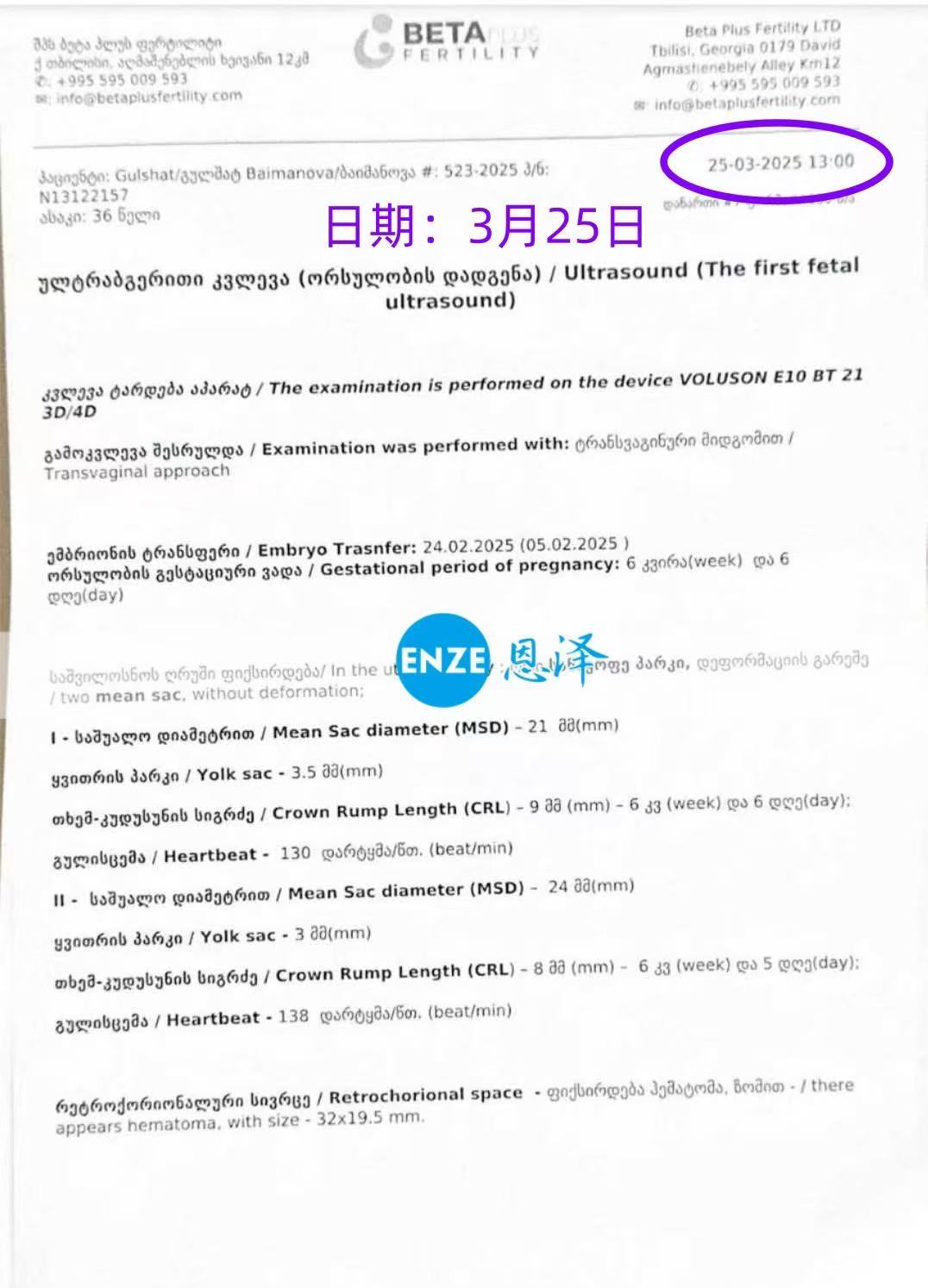 格鲁吉亚试管婴儿助孕爱心使者成功孕育双胎女儿