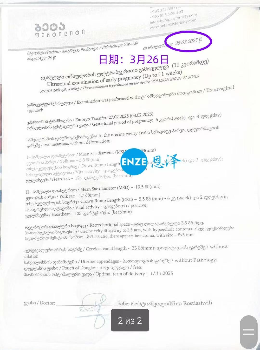 格鲁吉亚试管婴儿助孕爱心使者成功怀上双胎