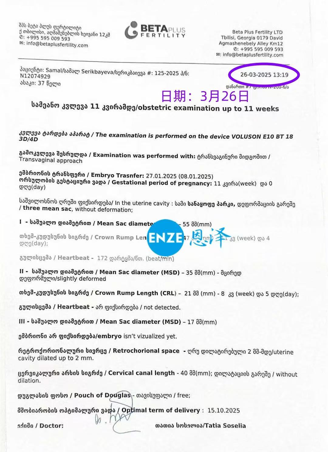 格鲁吉亚试管婴儿助孕爱心使者11周产检顺利过关