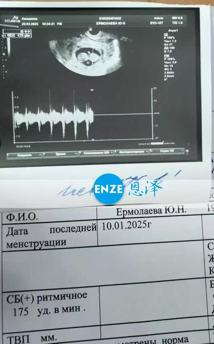 格鲁吉亚试管婴儿助孕爱心使者顺利通过11周产检
