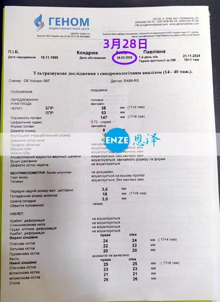 格鲁吉亚试管婴儿助孕爱心使者17周产检顺利通过