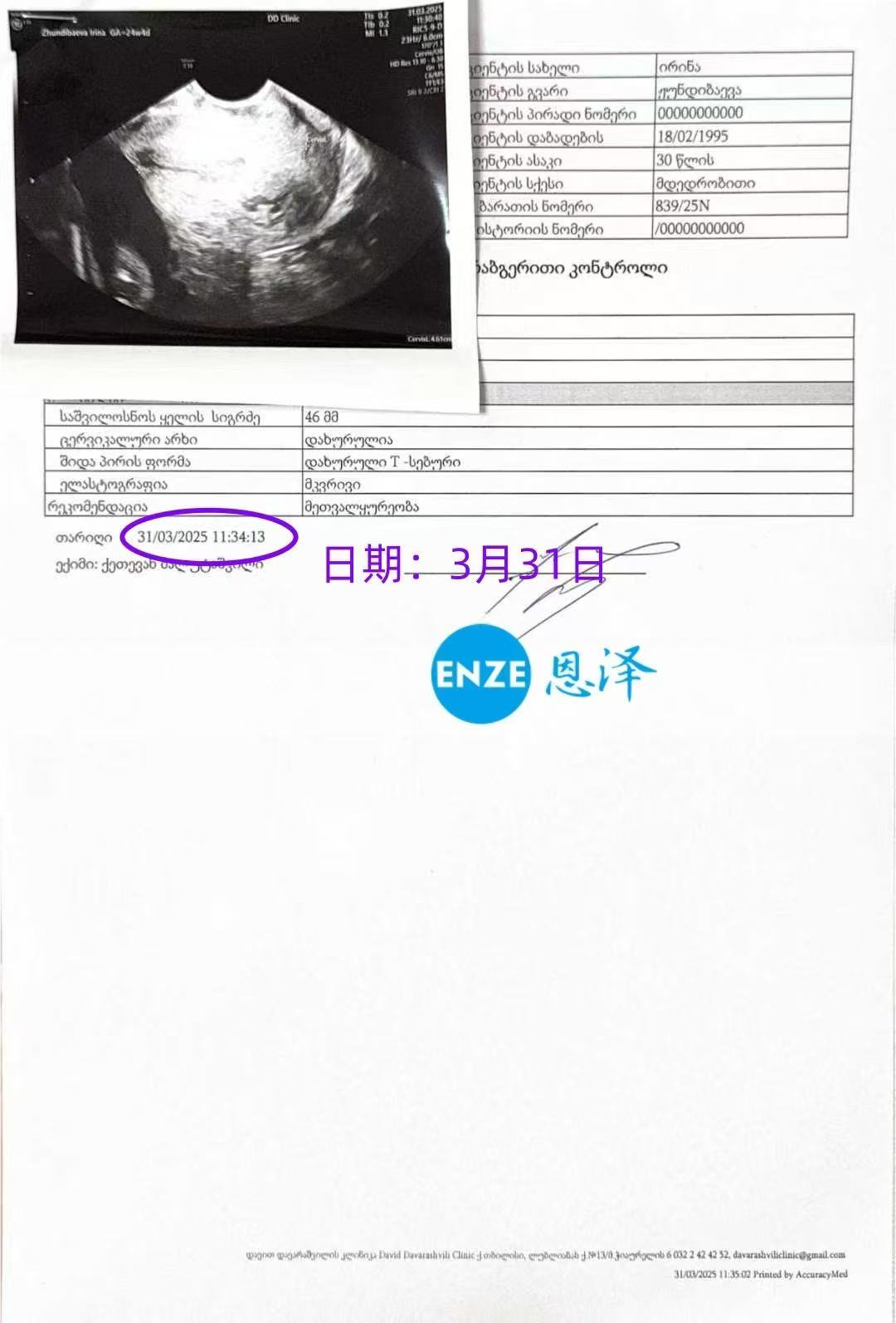格鲁吉亚试管婴儿助孕爱心使者24周产检顺利通过