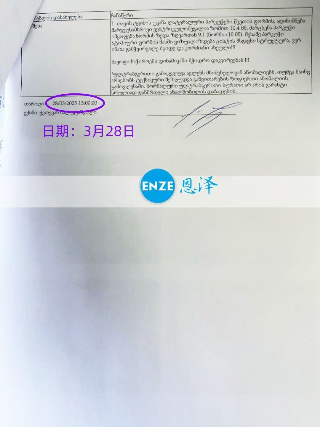 格鲁吉亚试管婴儿助孕爱心使者成功通过25周产检