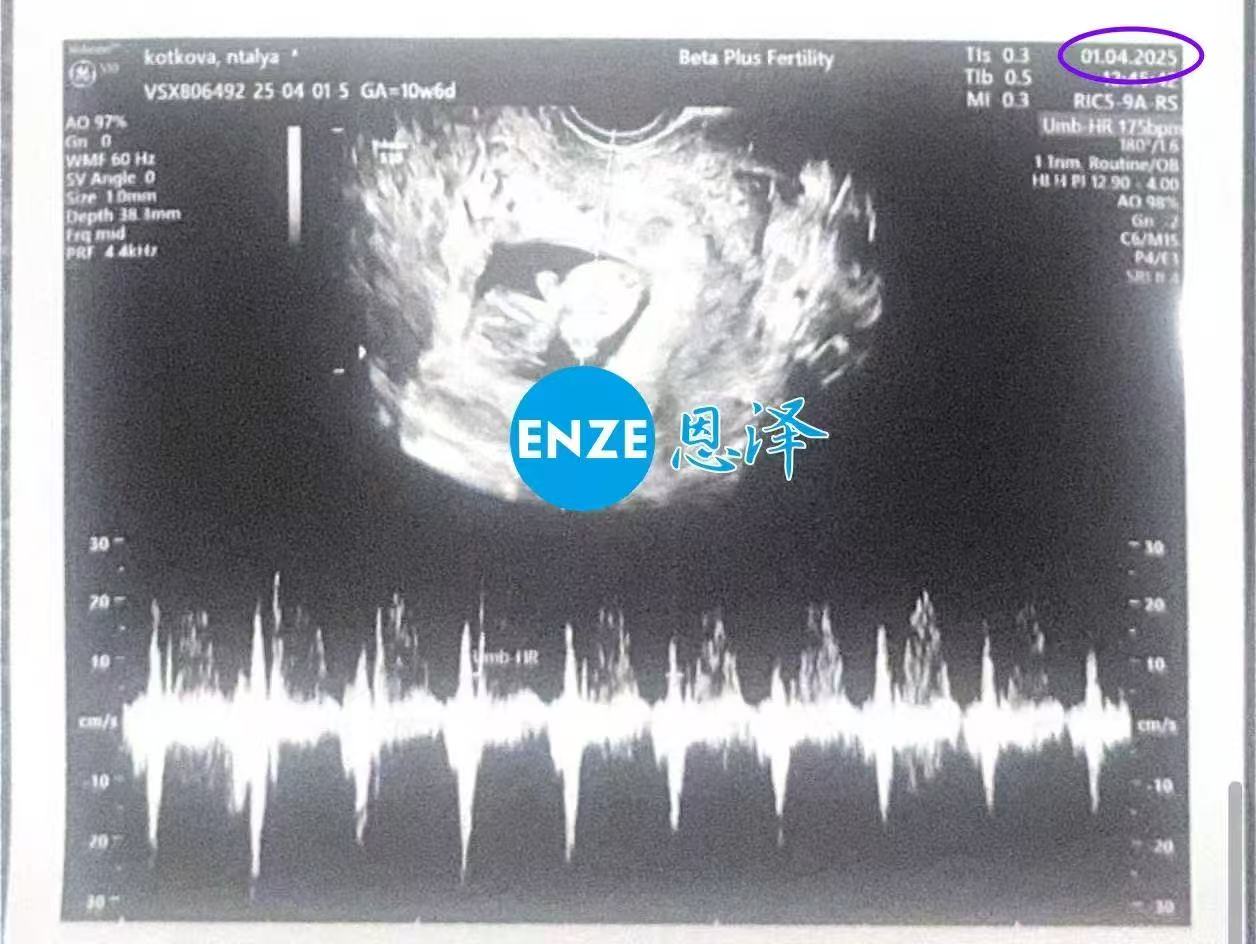 格鲁吉亚试管婴儿助孕爱心使者11周产检顺利过关