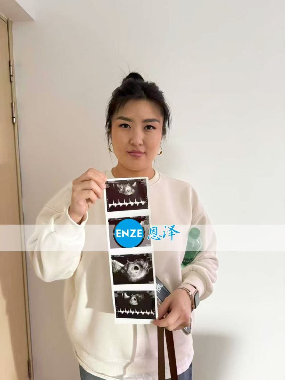 格鲁吉亚试管婴儿助孕爱心使者移植顺利