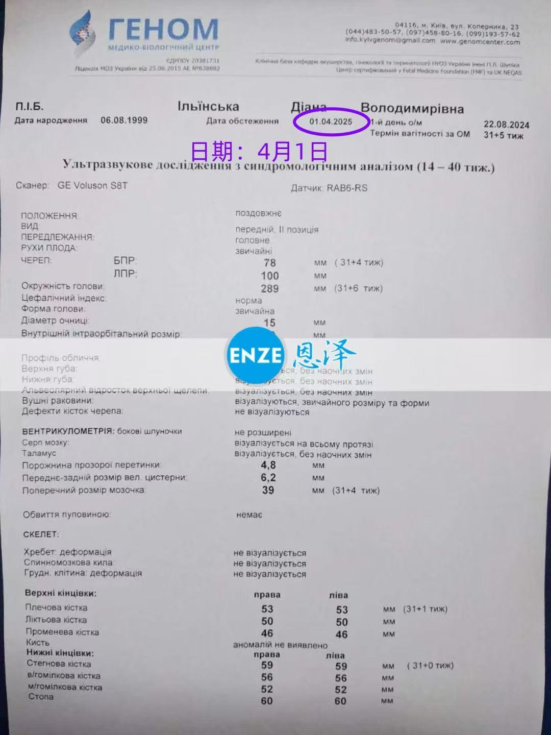 格鲁吉亚试管婴儿助孕爱心使者31周产检顺利通过