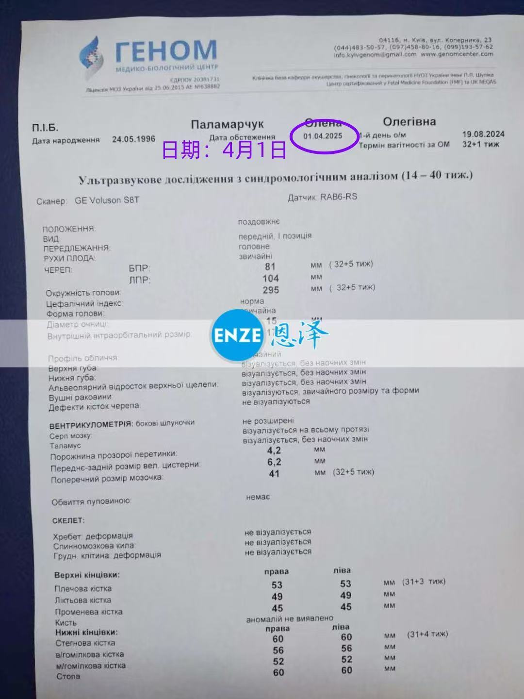 乌克兰试管婴儿助孕爱心使者32周产检顺利通过