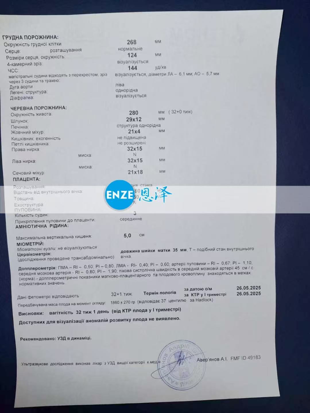 乌克兰试管婴儿助孕爱心使者32周产检顺利通过
