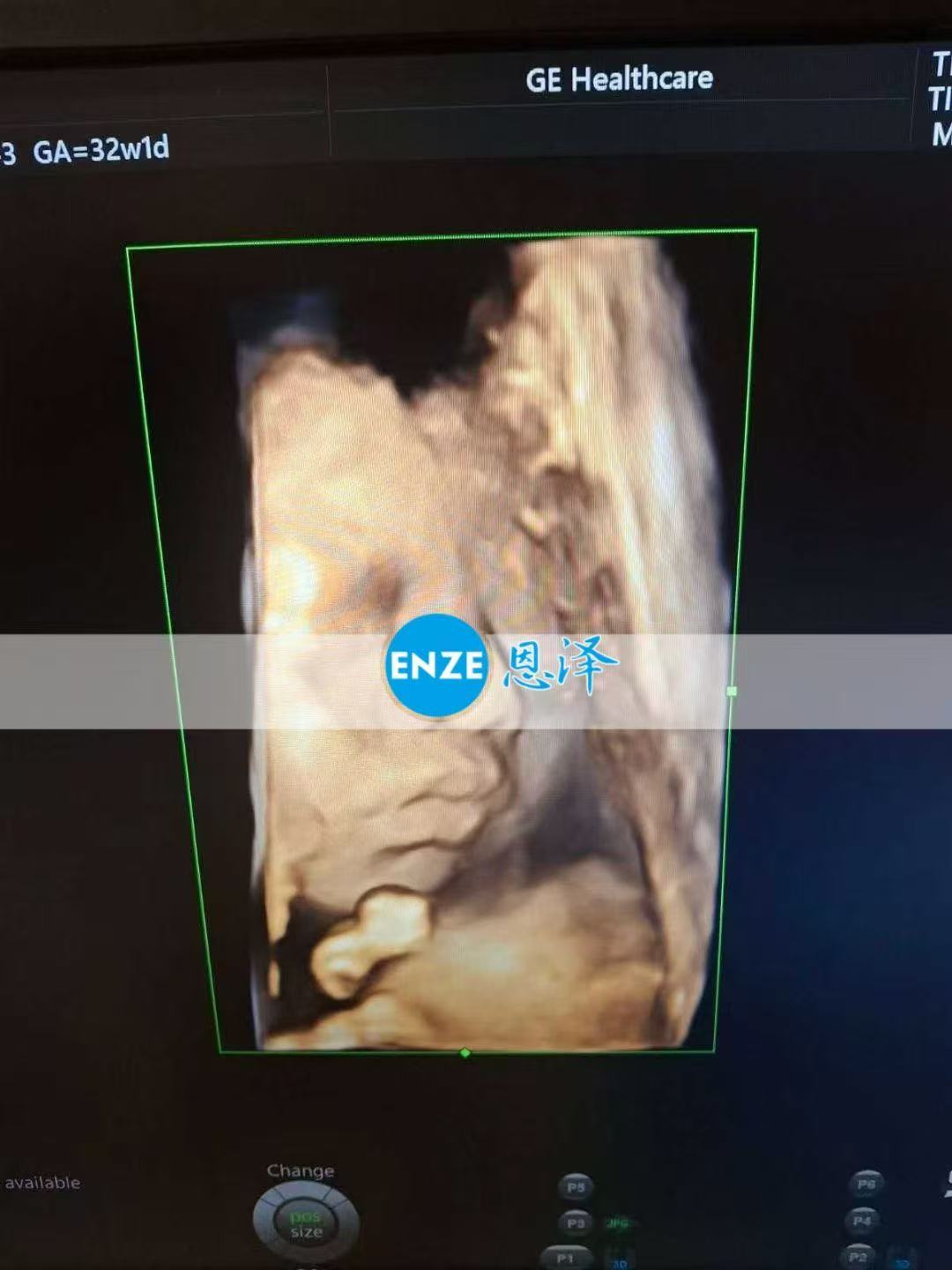 乌克兰试管婴儿助孕爱心使者32周产检顺利通过