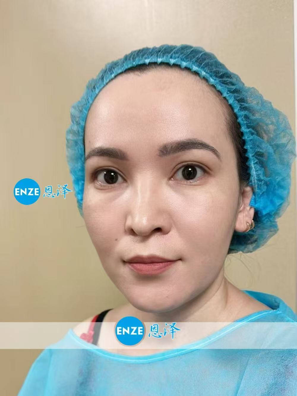 格鲁吉亚试管婴儿助孕爱心使者成功着床