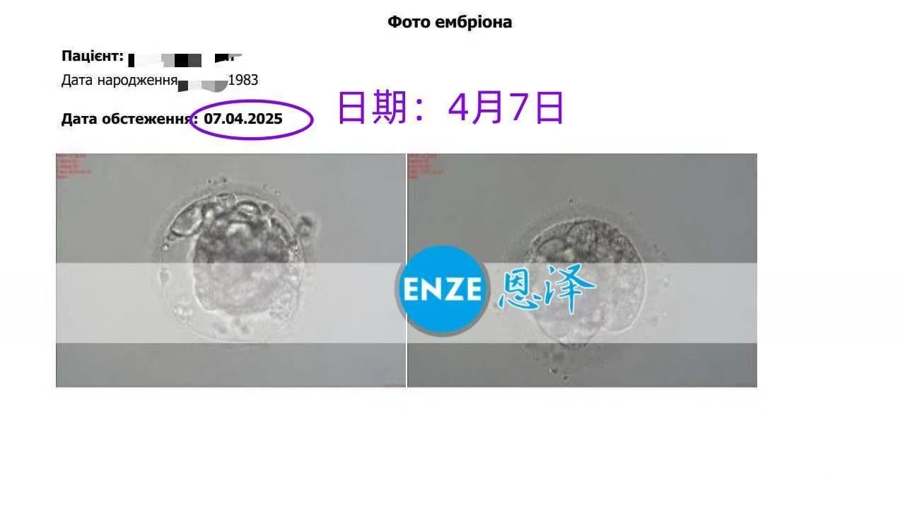 乌克兰试管婴儿助孕爱心使者顺利完成移植