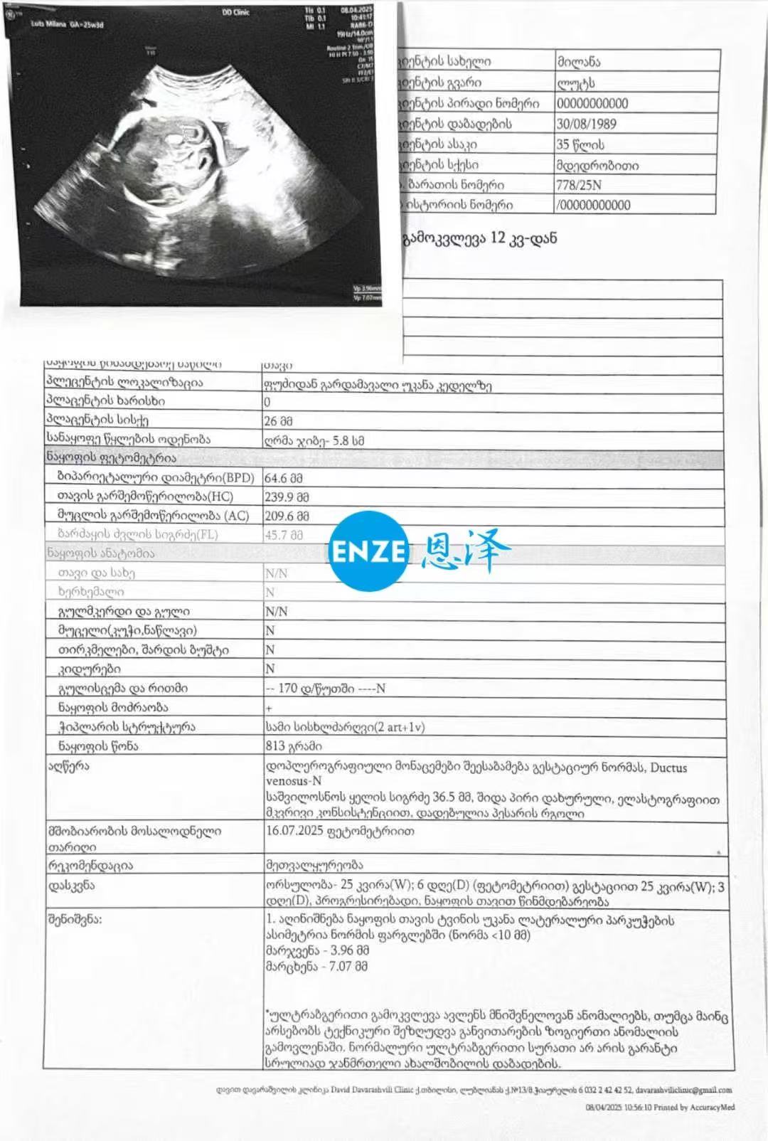 格鲁吉亚试管婴儿助孕爱心使者顺利通过25周产检