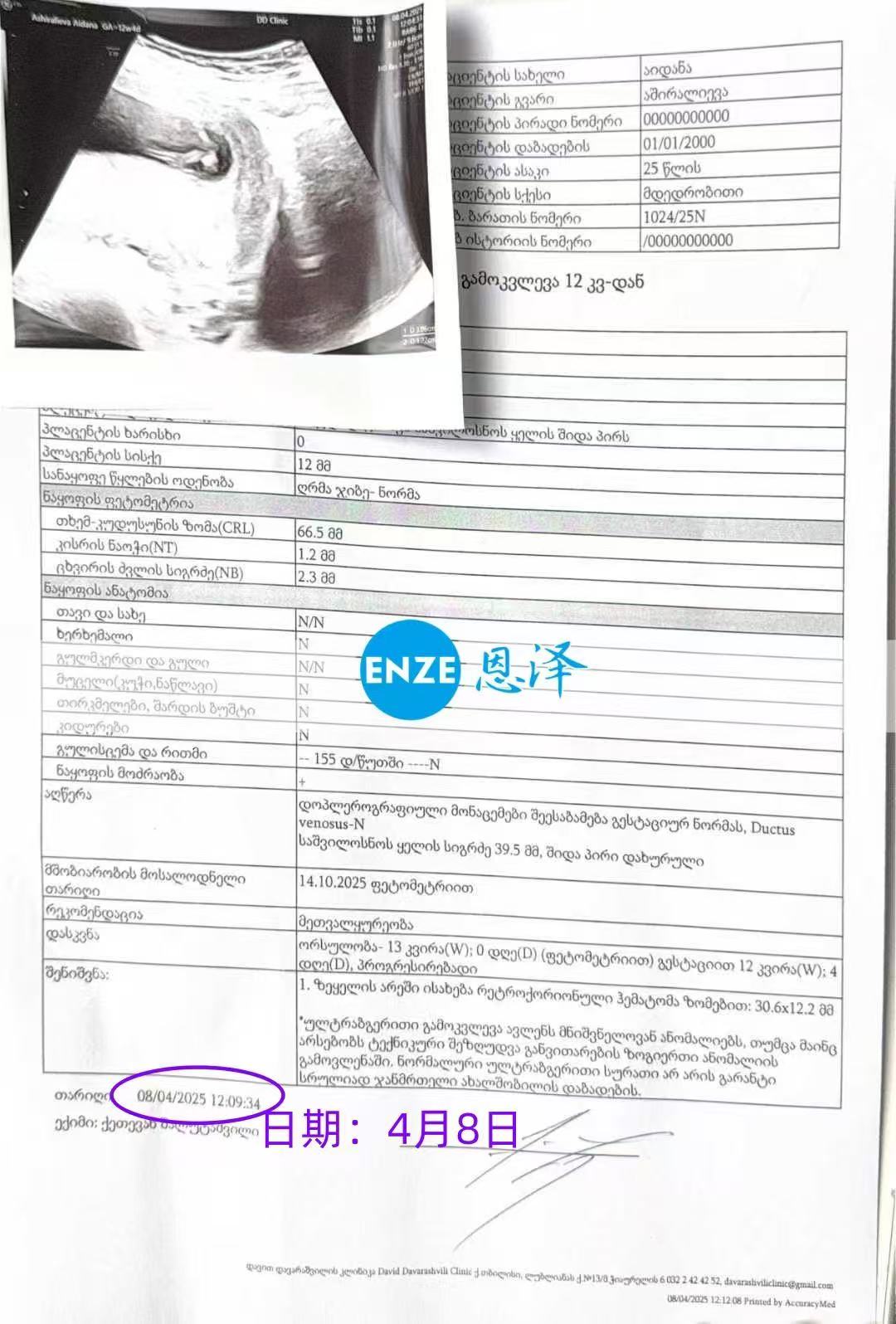 格鲁吉亚试管婴儿助孕爱心使者顺利度过风险期