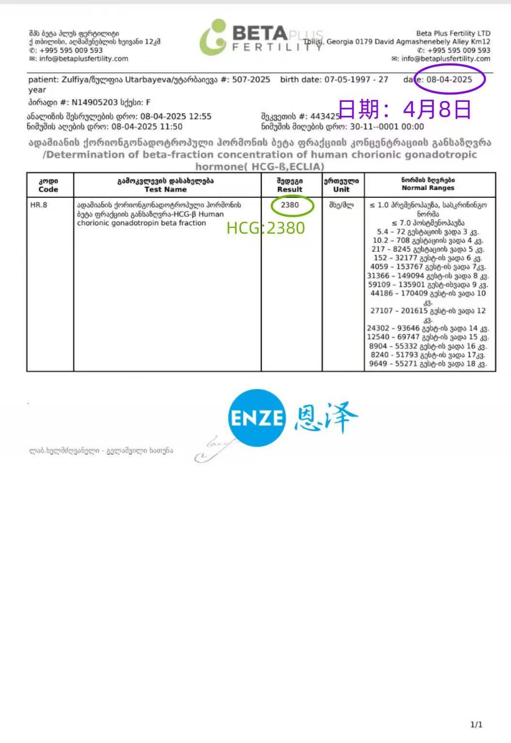 格鲁吉亚试管婴儿助孕爱心使者着床成功