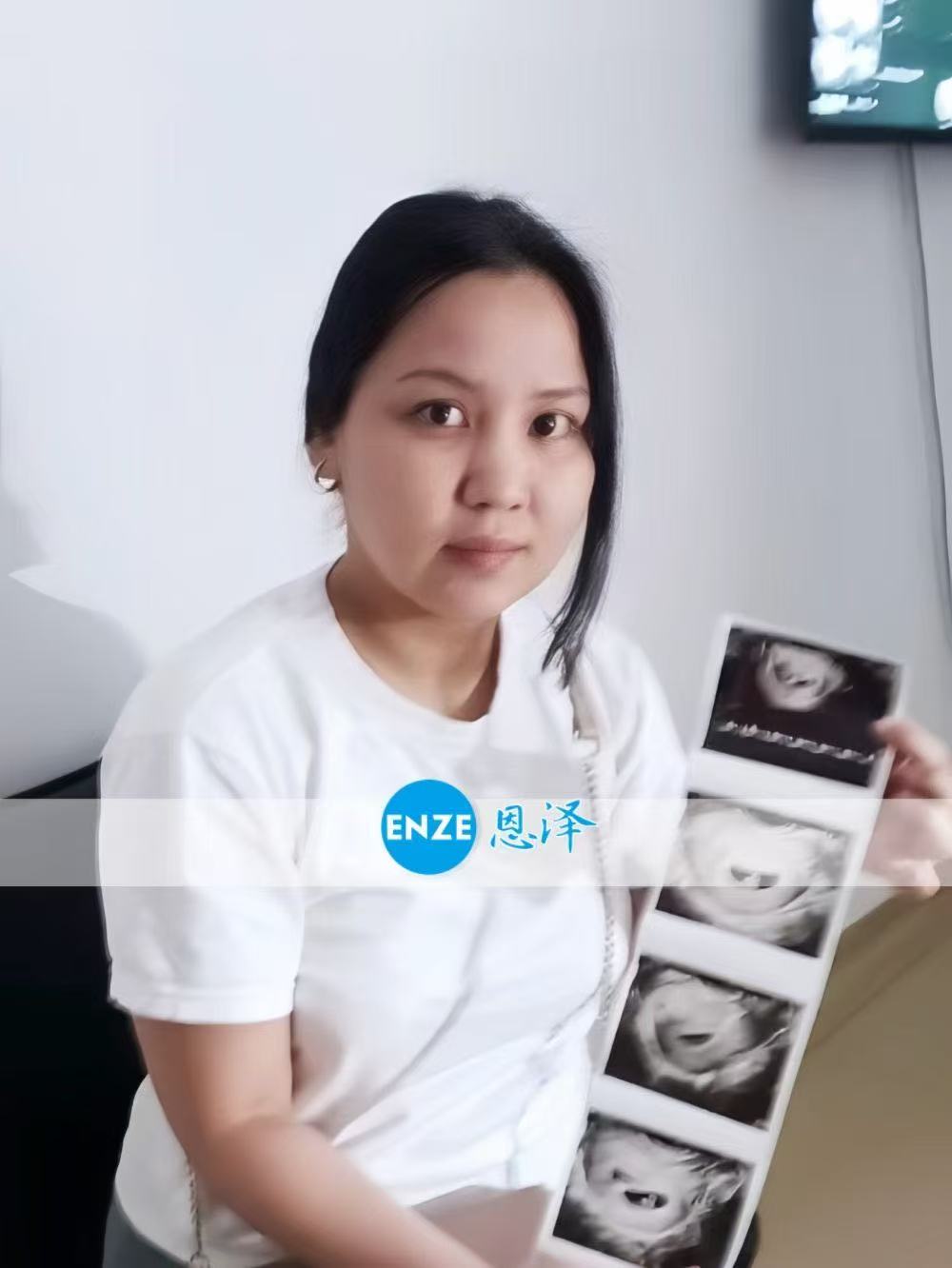 格鲁吉亚试管婴儿助孕爱心使者首次产检顺利过关