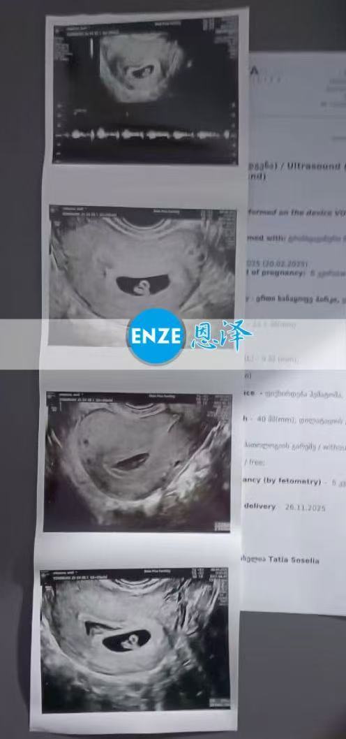格鲁吉亚试管婴儿助孕爱心使者首次产检顺利过关