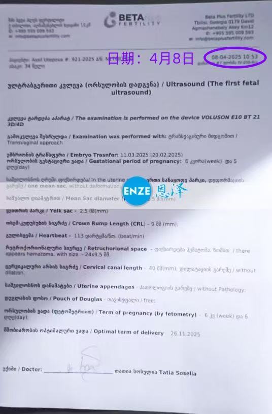 格鲁吉亚试管婴儿助孕爱心使者首次产检顺利过关